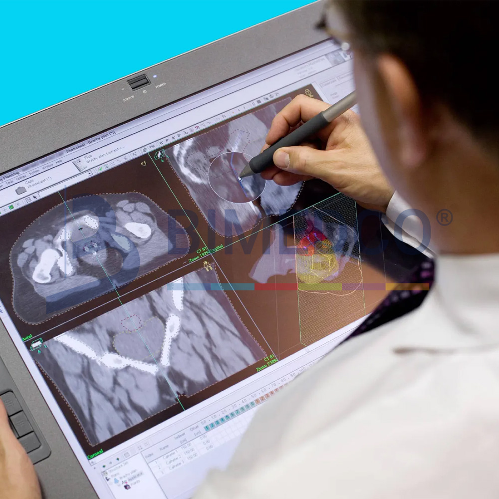 Oncentra Prostate