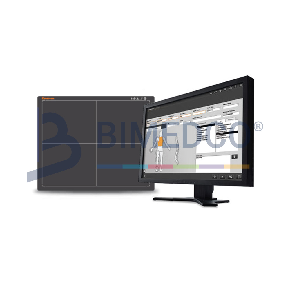 Focus 35c